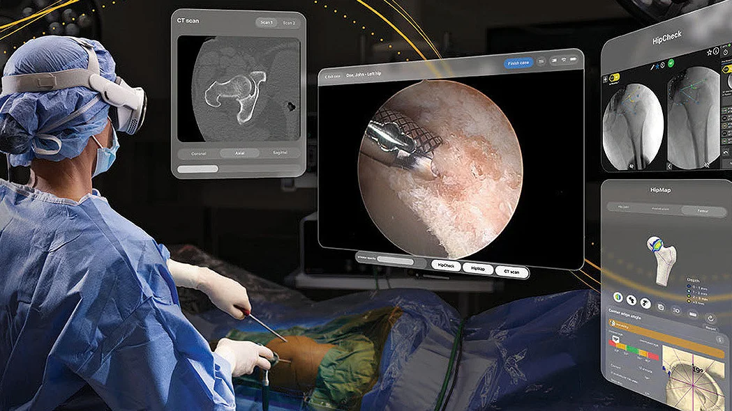 A surgeon just operated in Apple Vision Pro — newsletter story image